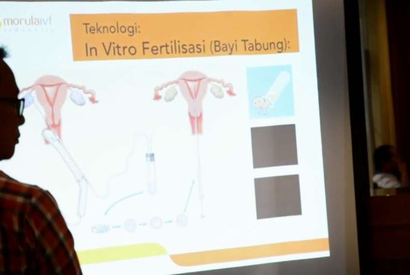 Presentasi proses program bayi tabung (ilustrasi)
