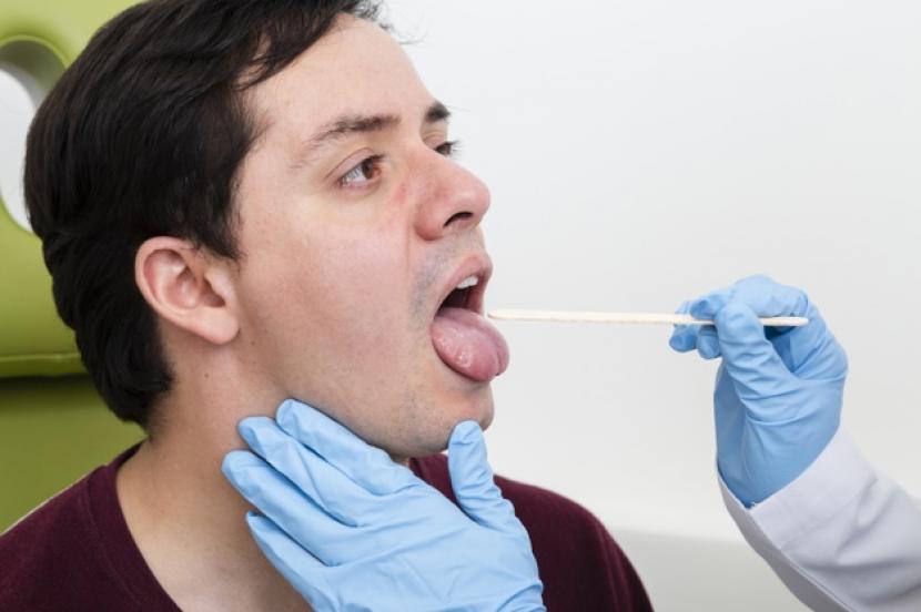 Profesor asal Inggris menemukan ada semakin banyak pasien Covid-19 yang melaporkan masalah oral, salah satunya perubahan dan pembengkakan lidah (ilustrasi).