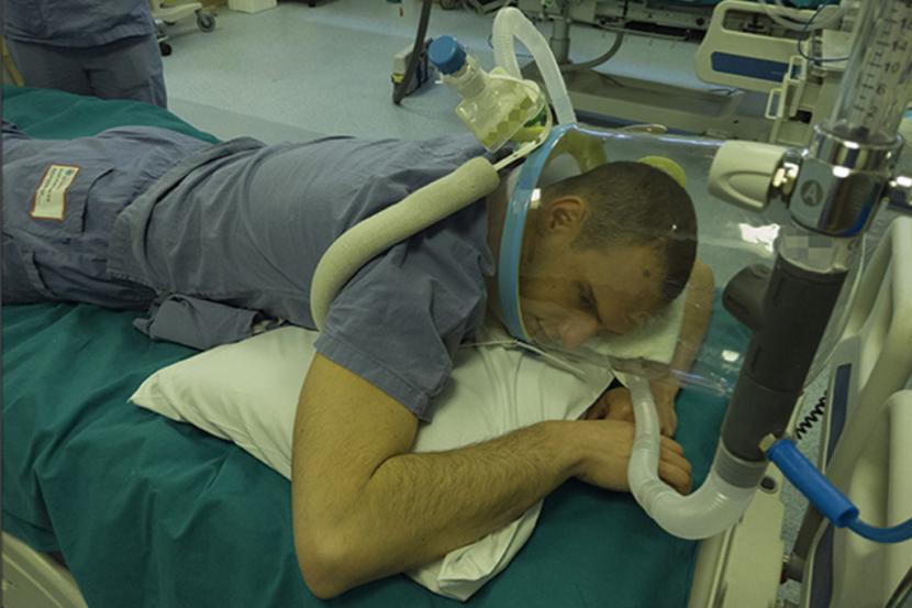 Proning position membuat paru bekerja lebih efisien hingga pasien Covid-19 lebih kecil kemungkinannya untuk memerlukan ventilator.