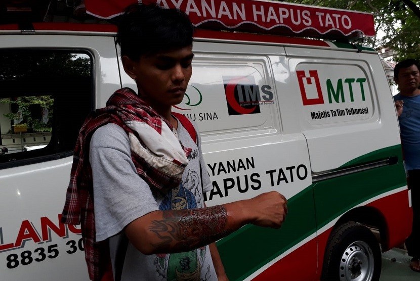 Rival (22 tahun) salah seorang peserta yang mendaftar dalam program Layanan Hapus Tato di halaman Masjid Cut Meutia, Jakarta Pusat, Sabtu (27/1).