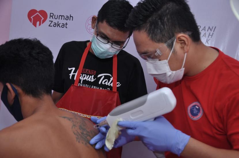 Rumah Zakat Cabang Pontianak kembali melaksanakan layanan bagi masyarakat berupa Program Removal Tattoo.