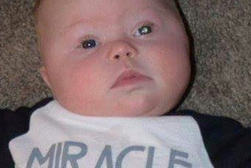  Ryder Temarantz, bayi berusia 4 bulan yang matanya terdeteksi mengalami kanker 