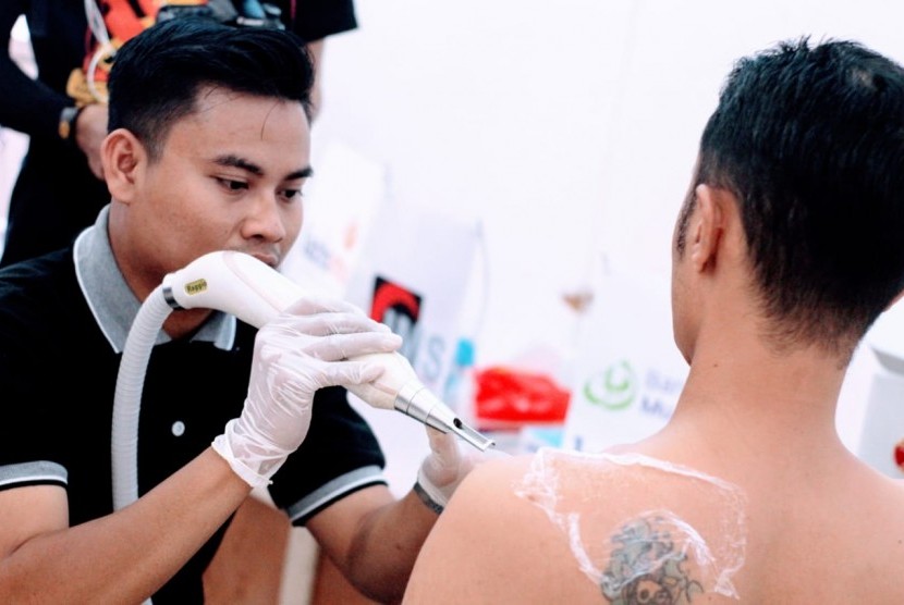 Salah seorang peserta program hapus tato se-Pulau Lombok yang diadakan oleh YBS. 