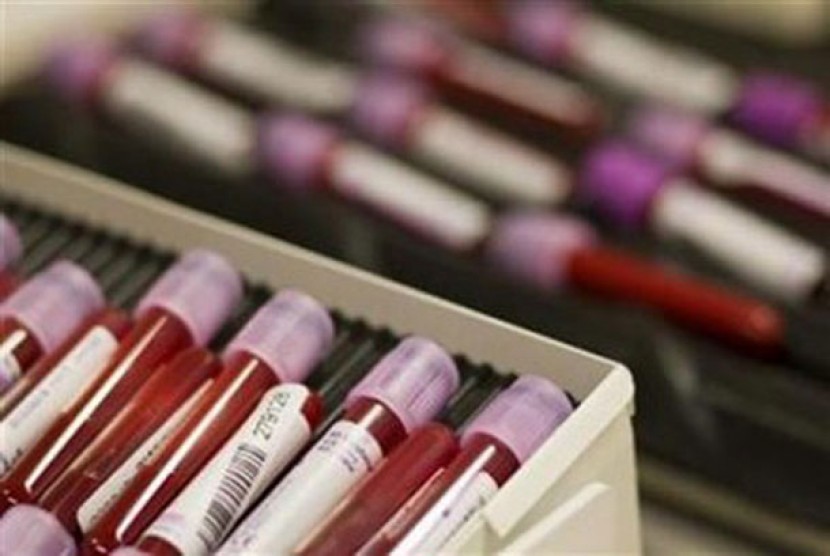 Sampel darah Mengandung sel kanker