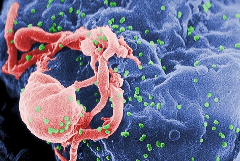 Scanning electron micrograph of HIV-1 (in green) budding from cultured lymphocyte. Multiple round bumps on cell surface represent sites of assembly and budding of virions. (illustration)