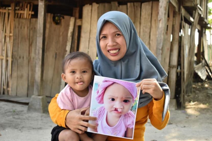 Senyuman Pasien Smile Train Indonesia bersama anaknya. 