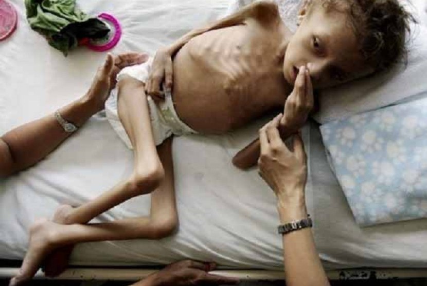 Seorang anak balita yang menderita kelaparan, (ilustrasi)