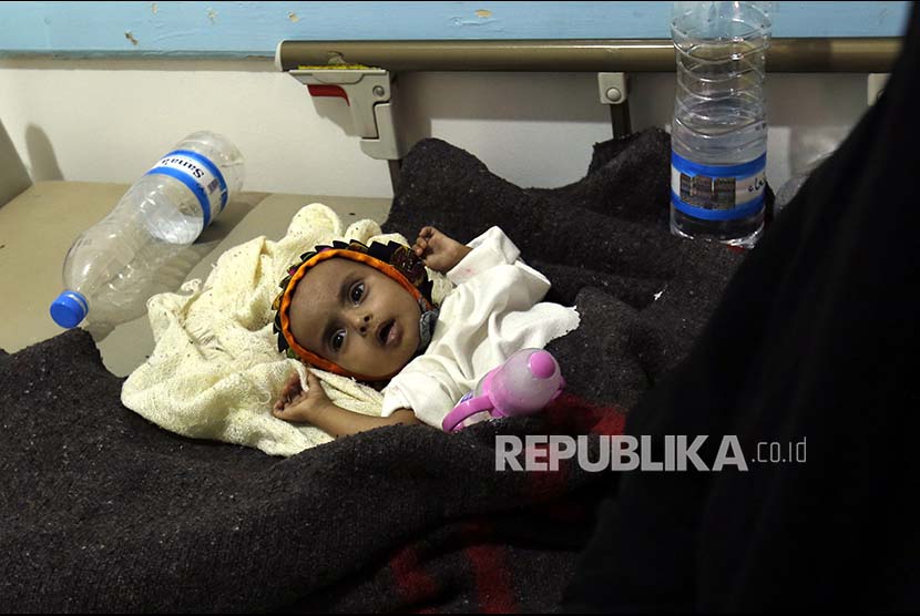 Seorang anak Yaman dirawat di rumah sakit setempat di Sana'a, Yaman. Menurut laporan PBB tiga juta balita Yaman terancam malnutrisi akibat konflik berkepanjangan antara dua pihak yang masing-masing didukung Arab Saudi dan Iran. 