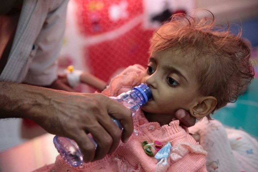 Seorang ayah memberi air kepada anaknya yang mengalami kekurangan gizi di sebuah rumah sakit di Yaman. (AP: Hani Mohammed)