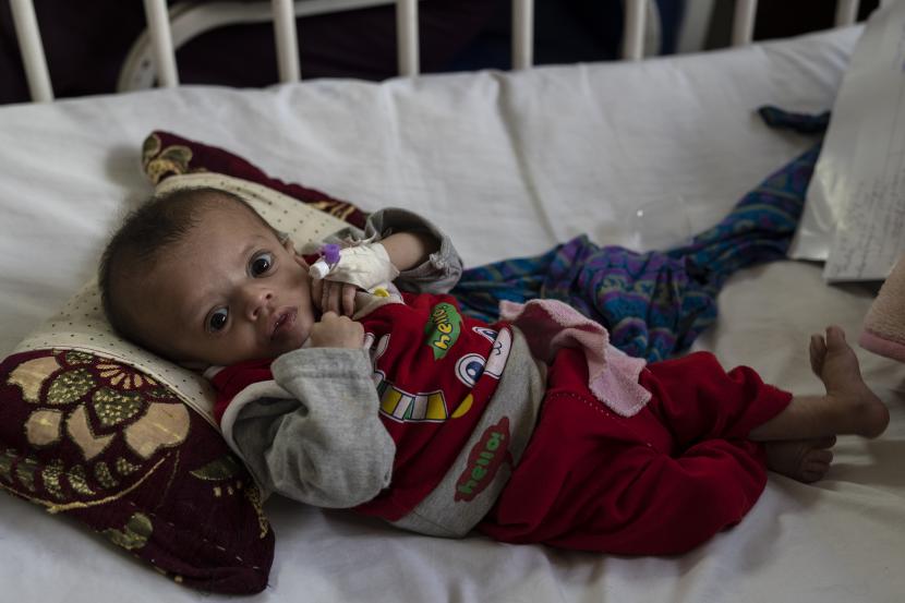 Seorang bayi laki-laki terbaring di tempat tidur saat menjalani perawatan di bangsal gizi buruk Rumah Sakit Anak Nasional Ataturk di Kabul, Afghanistan, Kamis, 2 Desember 2021. 