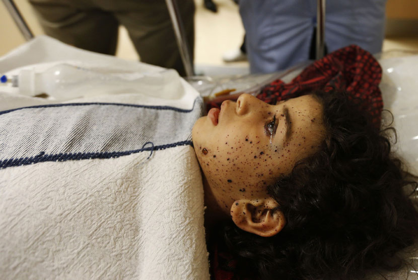 Seorang bocah Palestina, yang mengalami cedera akibat serangan Israel, menjalani perawatan di Pusat Medis Hussein, Amman, Ahad (13/7). 
