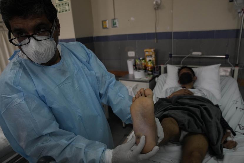 Seorang dokter menunjukkan lesi pada kaki pasien cacar monyet di RS Arzobispo Loayza di Lima, Peru, Selasa, 16 Agustus 2022. Cacar monyet yang tadinya endemik di Afrika kini ditemukan di banyak negara.