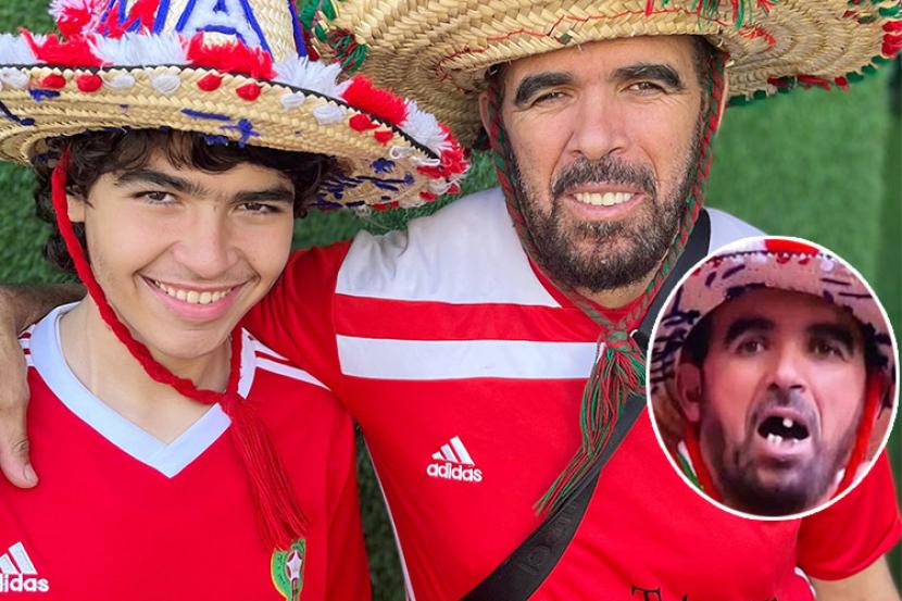 Seorang fan tim sepak bola Maroko di Piala Dunia Qatar 2022 jadi sasaran perundungan karena giginya yang ompong. Dokter Gigi Dubai Kembalikan Senyum Fan Maroko yang Dibully Gara-Gara Ompong