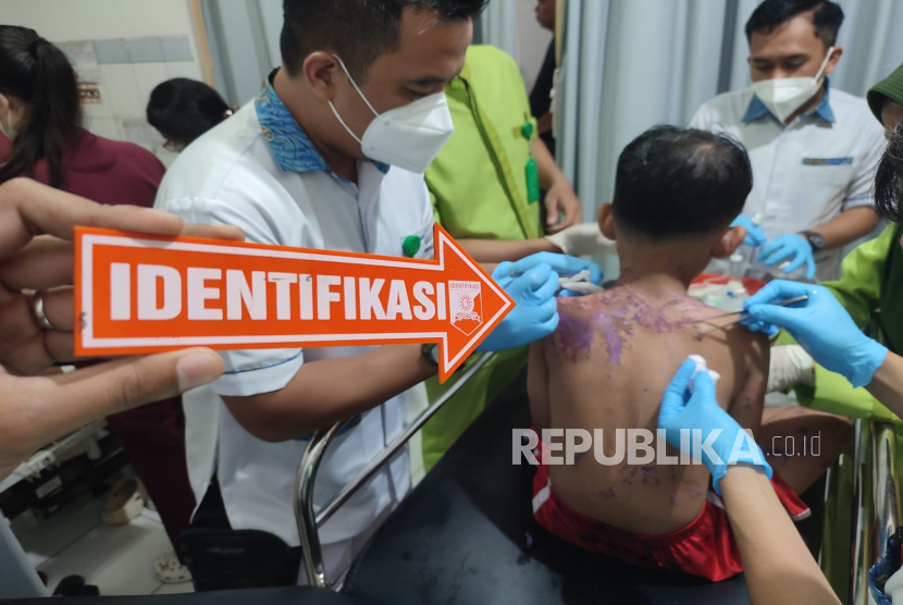 Seorang ibu berinisial YA (37 tahun) dan anaknya R (10 tahun) menjadi korban penyiraman air keras oleh orang tidak dikenal di Jalan Sudajaya, Kecamatan Baros, Kota Sukabumi, Kamis (1/5/2025). Akibat kejadian tersebut, korban mengalami luka bakar dan harus dilarikan ke rumah sakit untuk mendapatkan perawatan. 