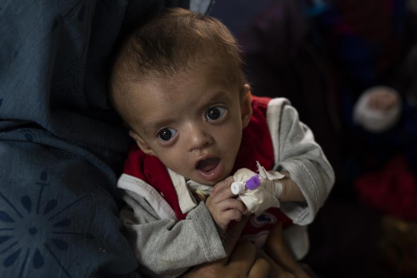 Seorang ibu menggendong bayinya saat menjalani perawatan di bangsal gizi buruk Rumah Sakit Anak Nasional Ataturk di Kabul, Afghanistan, Kamis, 2 Desember 2021. Menurut angka PBB dari awal November, hampir 24 juta orang di Afghanistan, sekitar 60% persen dari populasi, menderita kelaparan akut, termasuk 8,7 juta yang tinggal di dekat kelaparan.  Negara-negara Organisasi Kerja Sama Islam (OKI) pada Ahad (19/12) membentuk dana perwalian kemanusiaan untuk Afghanistan.