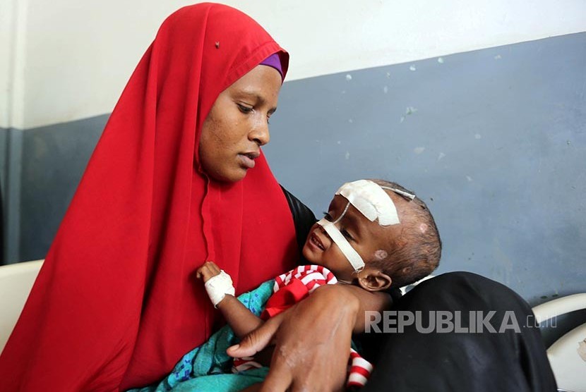 Seorang pengungsi kekeringan di Somalia membawa anaknyan yang menderita kekurangan gizi di RS Banadir, Mogadishu, Somalia. Pandemi dan invasi Rusia membuat biaya untuk anak kekurangan gizi makin membengkak. Ilustrasi.