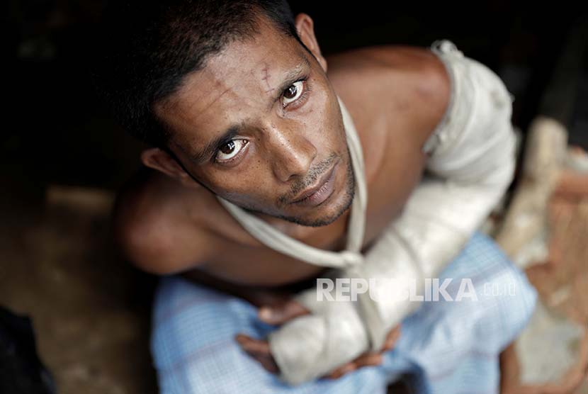 Seorang pengungsi Rohingya yang mengaku ditembak dan ditusuk oleh tentara Myanmar. 