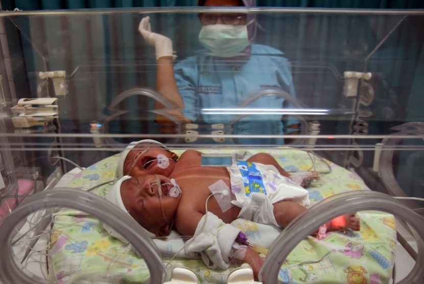 Seorang perawat berada di samping bayi perempuan berkepala dua yang dirawat secara intensif di ruang Neonatologi RSUD Ibnu Sina Gresik, Jawa Timur, Rabu (10/8). 