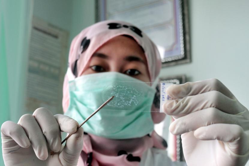 Seorang petugas tengah memeriksa sampel dahak pasien di ruang Laboratorium Tuberkulosis (TB).