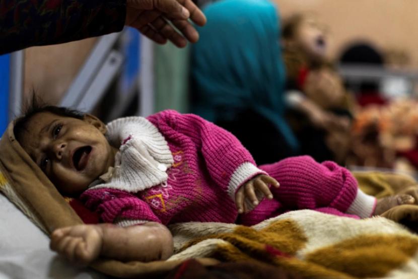 Seorang wanita menghibur bayi yang menangis di bangsal malnutrisi di Rumah Sakit Anak Indira Gandhi di Kabul.