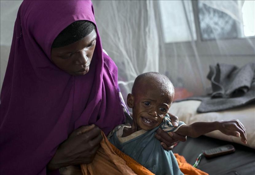 Seorang wanita Somalia menggendong anaknya menunggu perawatan medis di Rumah Sakit Regional Bay di Baidoa, ibu kota Negara Bagian Teluk Somalia. Ratusan ribu anak Somalia menjaliani perawatan kekurangan gizi 