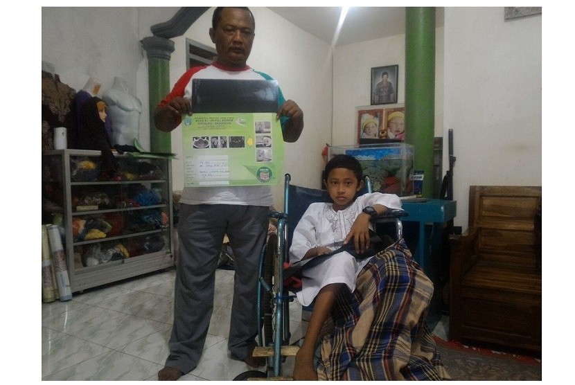 Setio Aldi (12) diduga menjadi korban malapraktik RSSA Kota Malang ketika operasi patah tulang. Kini kakinya membusuk dan pen-pen di kakinya mencuat keluar.