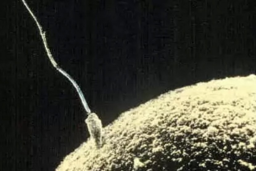 Sperm (illustration)