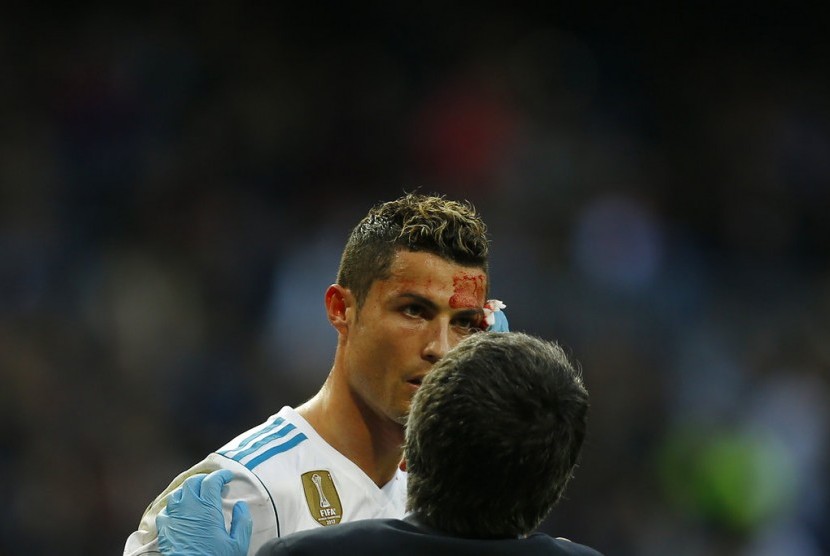 Striker Real Madrid, Cristiano Ronaldo terlihat mengalami pendarahan di kepalanya pada laga La Liga lawan Deportivo La Coruna, di Santiago Bernabeu, Ahad (21/1).