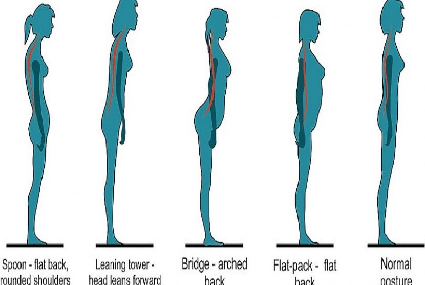 Struktur punggung berpengaruh kepada kemungkinan sakit punggung di masa mendatang