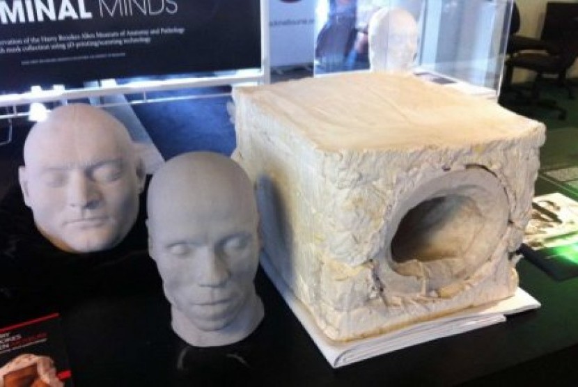 Teknologi mesin cetak 3D memungkinkan orang mencetak tulang pengganti untuk seluruh bagian tubuh dengan lebih akurat dan cepat.  