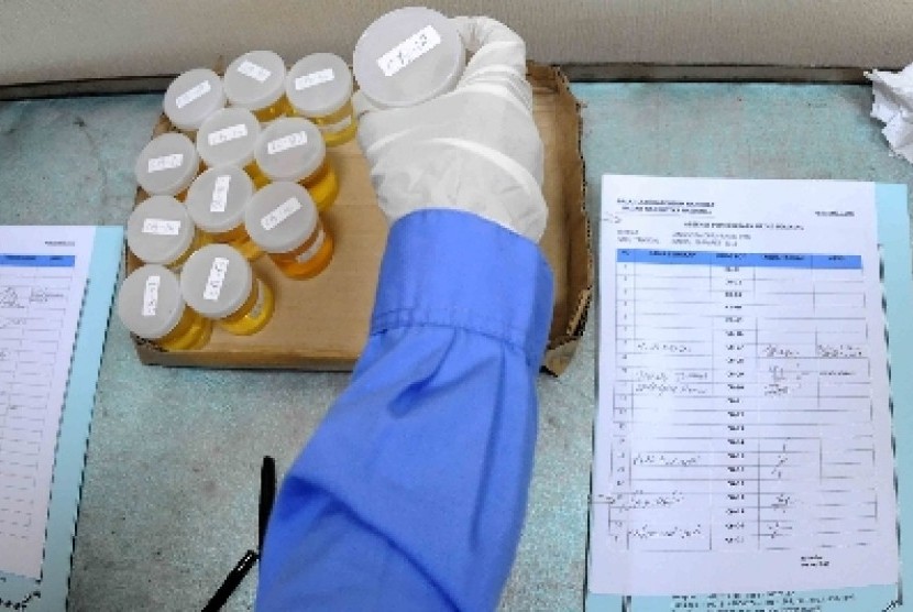 Tes urine untuk mengidentifikasi penggunaan narkoba.