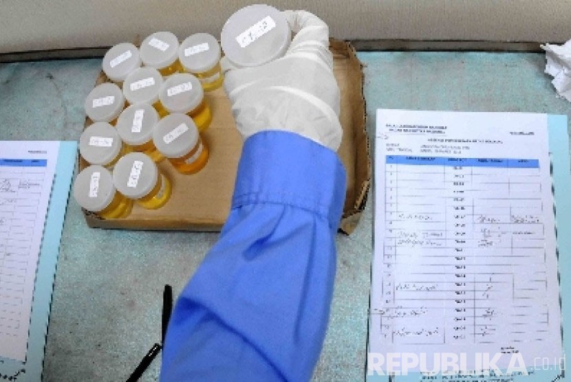 Tes urine untuk mengidentifikasi penggunaan narkoba, salah satu yang harus dijalani pasangan calon yang mengikuti Pilkada (ilustrasi)