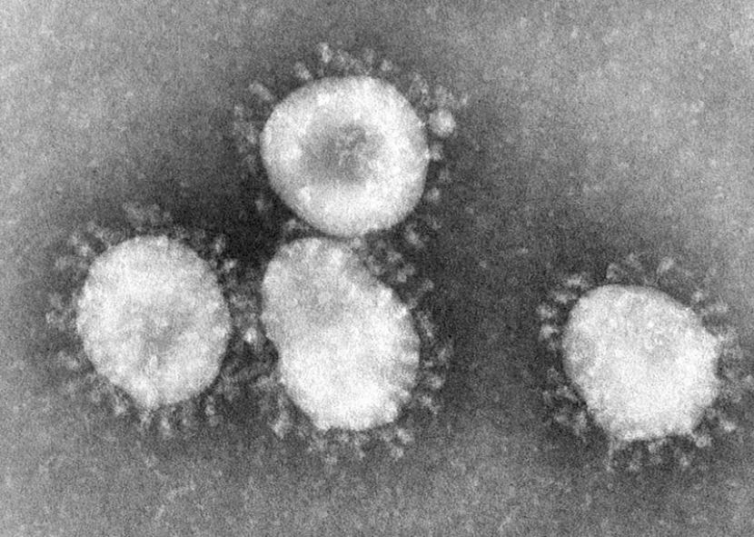 Virus corona dalam tampilan mikroskopik. (ilustrasi)