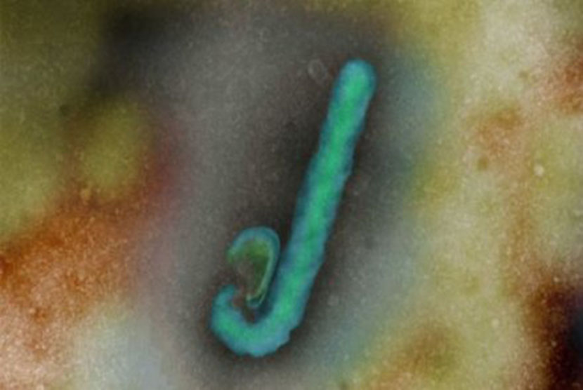  Ebola virus (illustration)