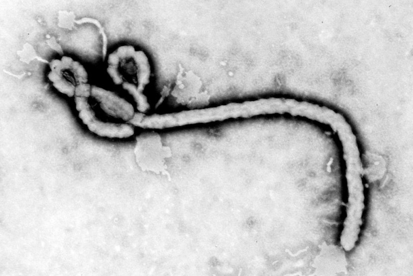 Negara Guinea Khatulistiwa secara resmi mengumumkan munculnya wabah pertama virus Marburg, penyakit yang mirip dengan Ebola, pada Senin (13/2/2023). ilustrasi