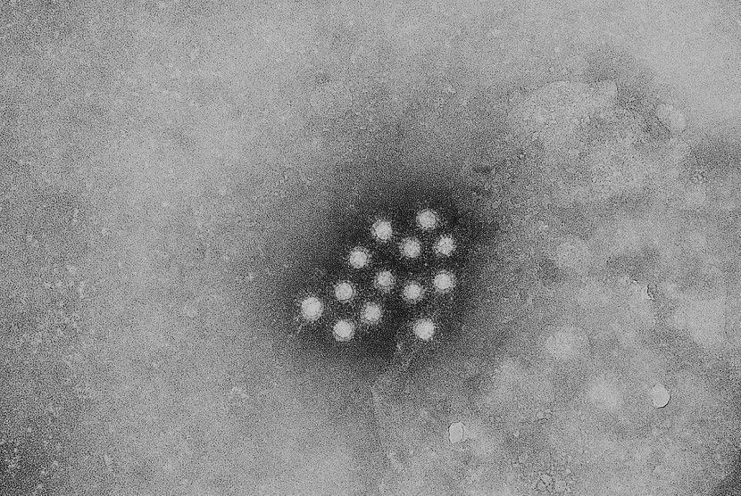 Virus hepatitis A