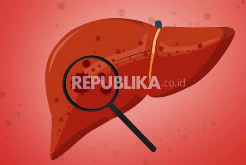 Wabah hepatitis misterius (ilustrasi).