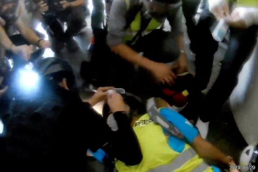 Wartawan Indonesia Veby Mega Indah menerima tindakan medis darurat ketika matanya ditembak peluru karet polisi Hong Kong, Ahad (29/9).