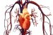 Penyakit jantung/ilustrasi