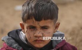 Potret Adam Suleiman Abu Halib, seorang anak Palestina berusia lima tahun yang wajahnya penuh bekas luka akibat serangan Israel berpose di Kota Gaza, Kamis (22/1/2026). Adam mengalami cedera akibat serangan Israel di kota Deir Al-Balah, Jalur Gaza tengah pada akhir tahun 2023. Serangan Israel itu meninggalkan bekas luka di wajah, yang juga menyebabkan hilangnya penglihatan total di mata kirinya. Kini Adam bersama keluarganya masih menunggu izin keluar dari Gaza  untuk mendapatkan perawatan medis, karena kurangnya fasilitas medis yang memadai di dalam Jalur Gaza.