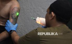 Seorang peserta menjalani proses penghapusan tato dalam kegiatan Hapus Tato Gratis bersama Hijrah Care di Masjid Jaza, Jalan Trunojoyo, Kota Bandung, Kamis (10/9/2026). Treatment dilakukan bagi warga yang ingin menghapus tato sebagai bagian dari langkah untuk memulai perubahan.