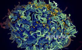 Gambar mikroskop elektron berwarna menunjukkan sel T manusia, berwarna biru, sedang diserang HIV, dan berwarna kuning, virus penyebab AIDS.
