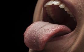 Seorang pria menjulurkan lidahnya. Warna lidah dapat menjadi pertanda awal penyakit seperti kanker dan diabetes.