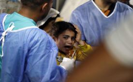 Petugas medis merawat seorang gadis yang terluka dalam pemboman Israel di Jalur Gaza di kamp pengungsi Rafah, Gaza selatan.
