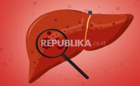 Infografis Wabah Hepatitis Misterius | Republika Online