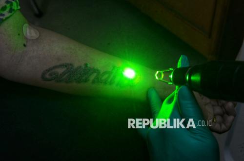 Menghapus Tato, Menyulam Harapan Baru di Bulan Ramadhan