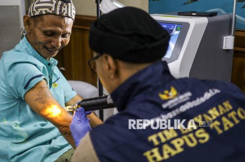 Layanan Hapus Tato, Ikhtiar Menyambut Lembaran Baru