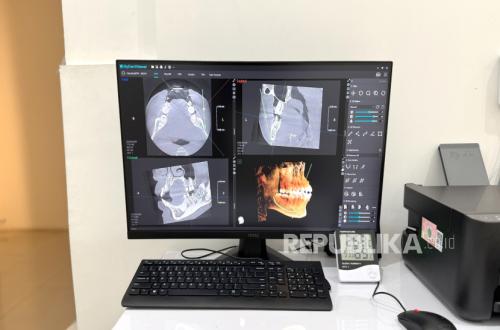Teknologi CBCT Bantu Dokter Lakukan Diagnosis Gigi Lebih Akurat