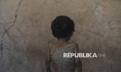 Gaza Terancam Kehabisan Makanan Terapeutik, Anak-anak Jadi Korban