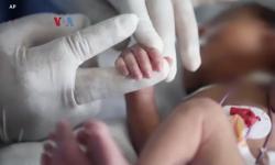 Perawat Diduga Gunting Jari Bayi di RS Palembang, Polisi Lakukan Penyelidikan